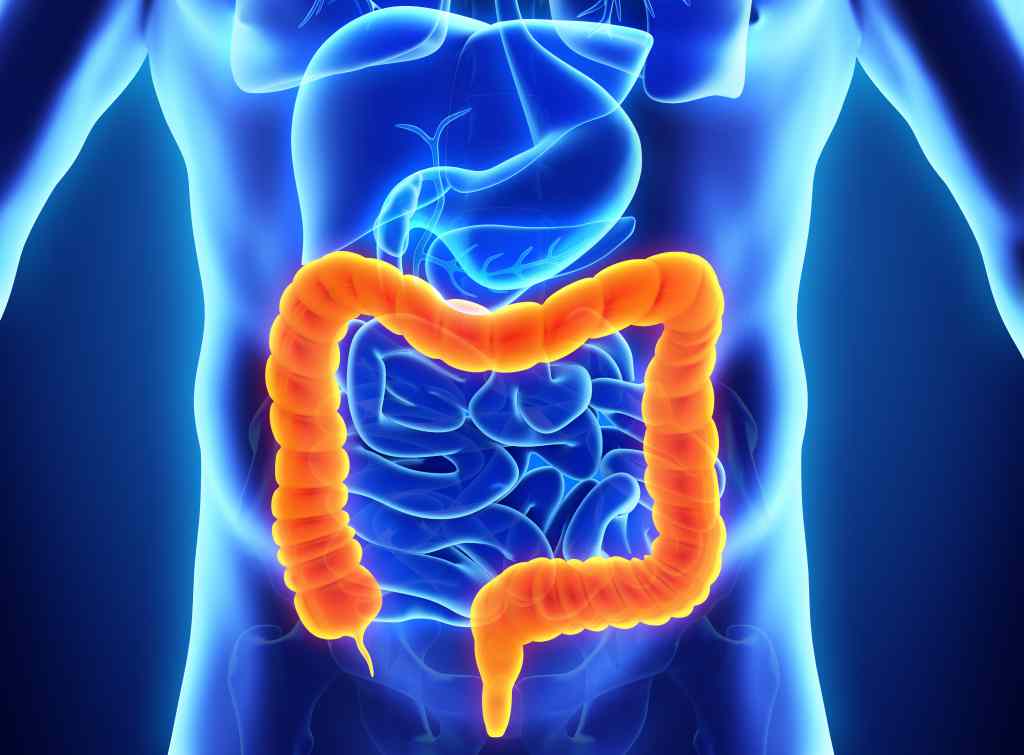 6 Tanda Kanker Usus Besar yang Sering Disepelekan